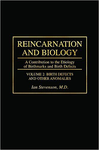 Stevenson-Reincarnation and Biology-A Contribution to the Etiology of Birthmarks and Birth Defects